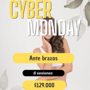 Ante brazos - 6 sesiones